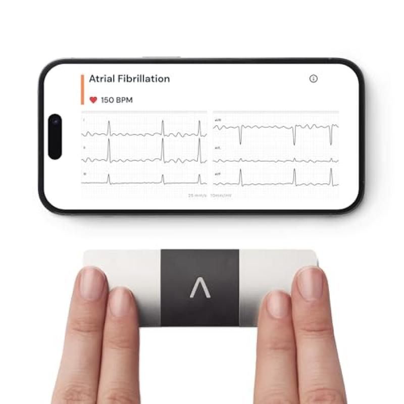 KardiaMobile 6-Lead ECG Monitor