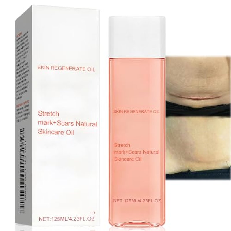 Oil Stretch Mark & Scar Treatment