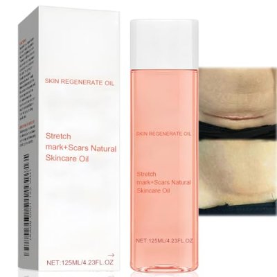 Oil Stretch Mark & Scar Treatment